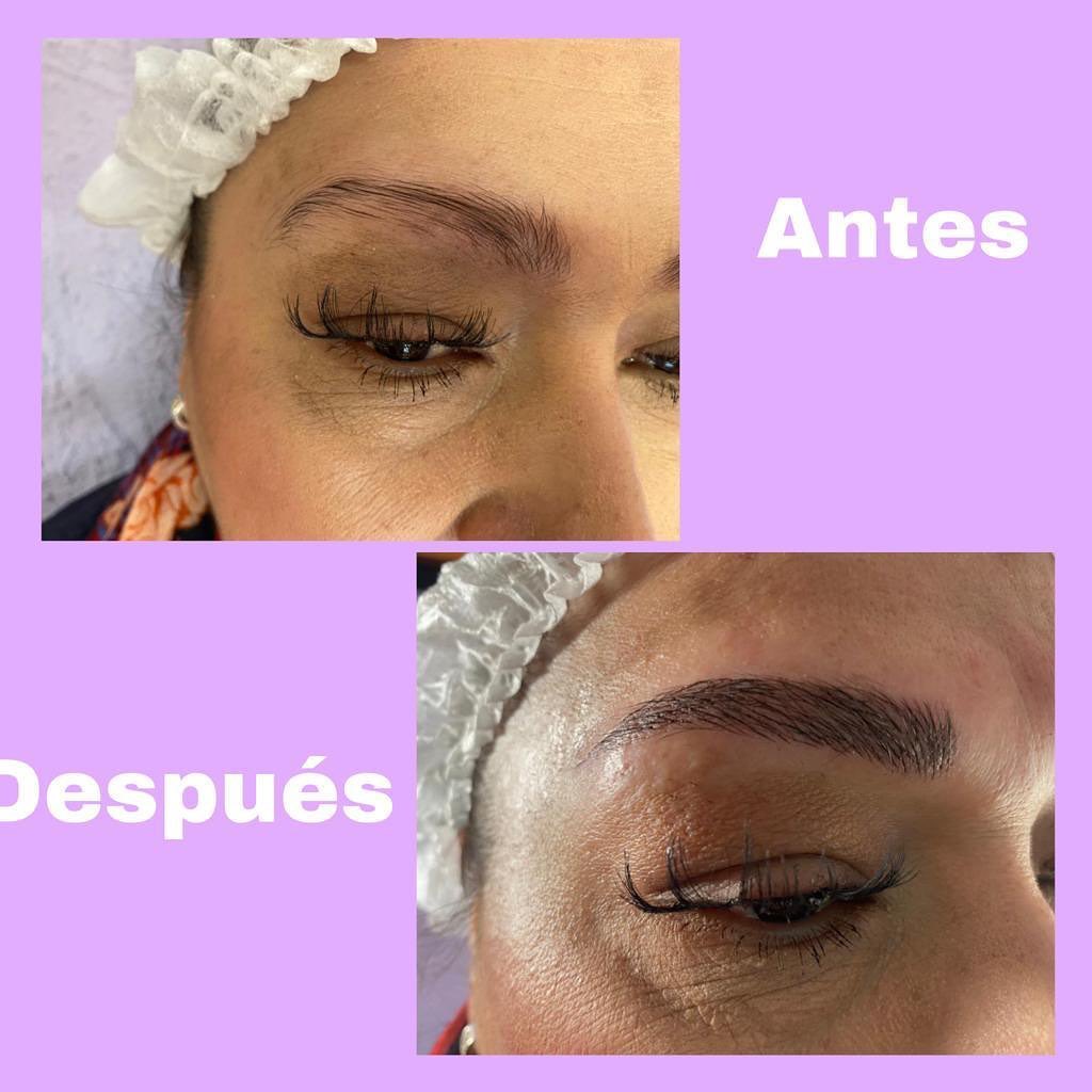 cejas tratamiento